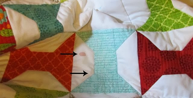 How to Remove Blood from a Quilt